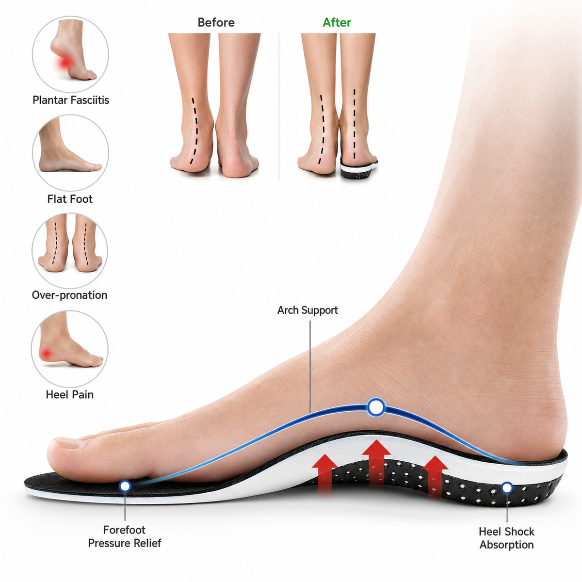 COMFOFEET® Orthopedic Soles - 2 Pack